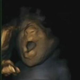 Image for article titled New photographs reveal that fetuses yawn in the womb